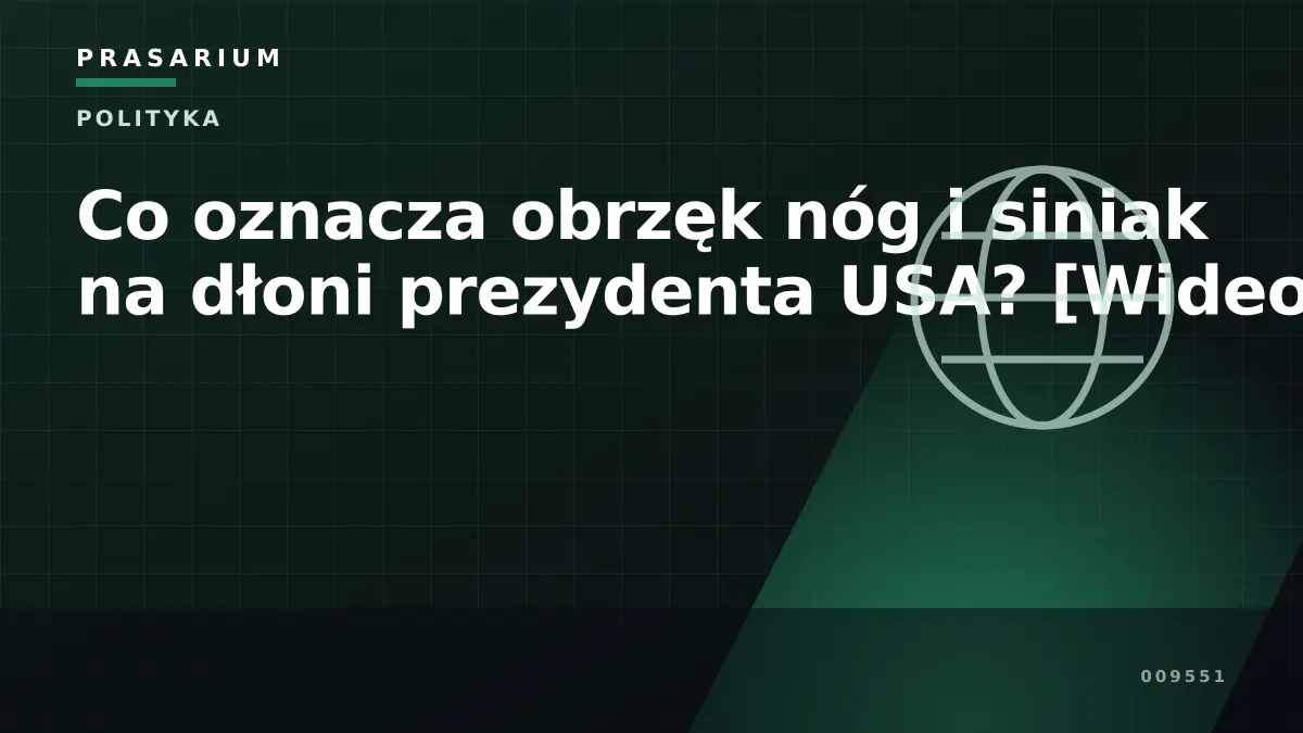 Co oznacza obrzęk nóg i siniak na dłoni prezydenta USA? [Wideo]